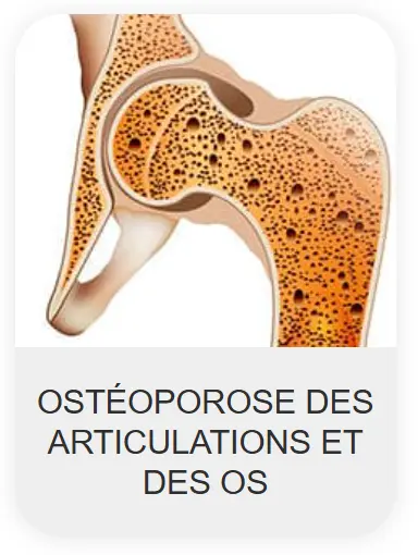 Chondrolax-ma-Morocco