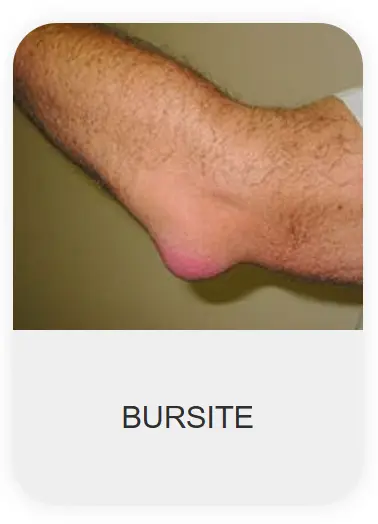 Chondrolax-ma-Morocco