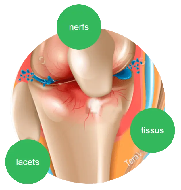 Chondrolax-ma-Morocco