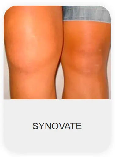 Chondrolax-ma-Morocco